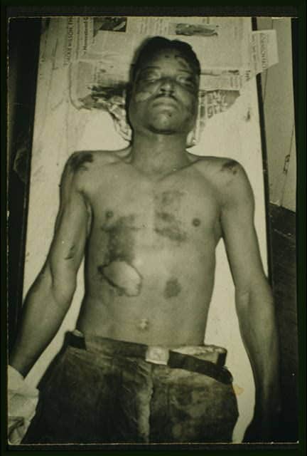 Robert Hall Postmortem Photograph, 1943 (Wikipedia) Robert Hall Postmortem Photograph, 1943 (Wikipedia)