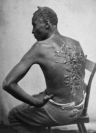 Whipped Peter, Baton Rouge, LA, April 2, 1863 (Wikipedia)